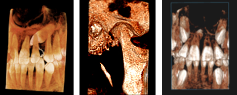 Camara Intraoral de la Clínica