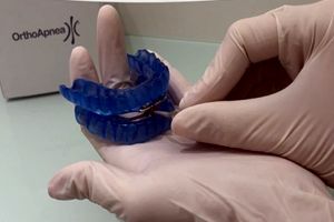 OrthoApnea es un dispositivo intraoral
