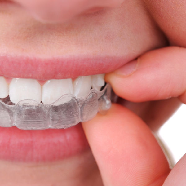 Ortodoncia Dental