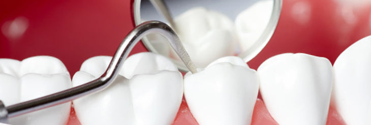 Periodoncia con Láser Dental