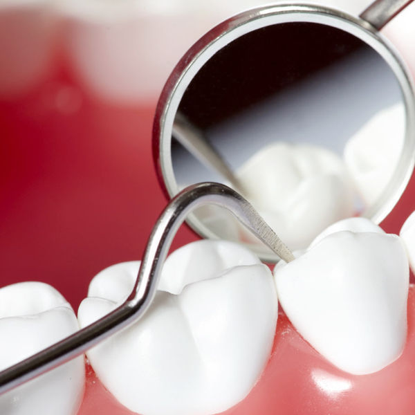 Periodoncia