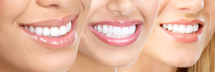 Prótesis Dentales Prótesis Dentales