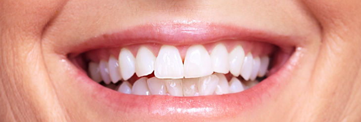 Rehabilitación Oral Completa